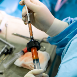 Exploring Fat Grafting: Macro Fat/ Regular Fat, Micro Fat, and Nano Fat